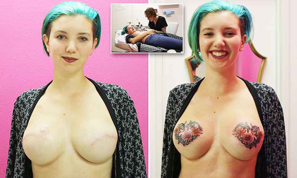 Breast Cancer Surviving Amateur Porn.
